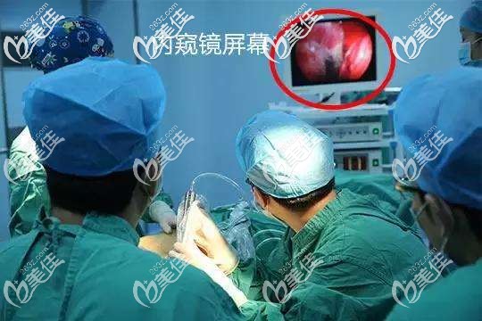 内窥镜隆胸是一种技术