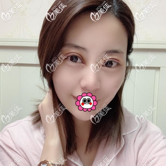 术后恢复7天拆线