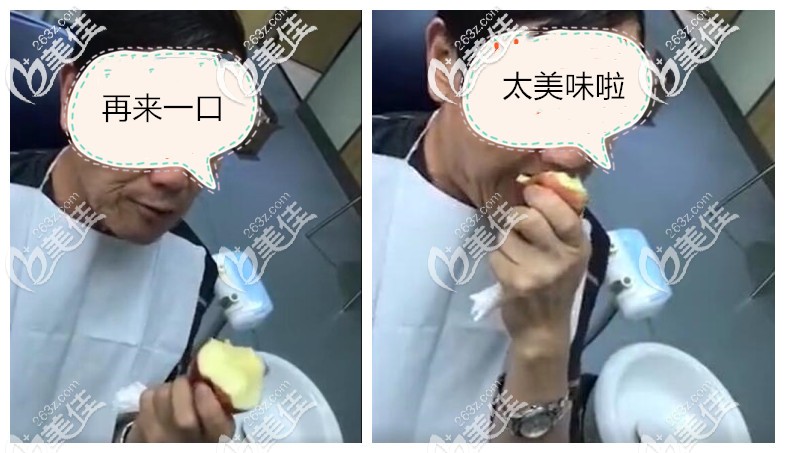 重庆牙管家口腔给老人做的全口吸附性义齿的真的这么好用，当场试验了吃苹果