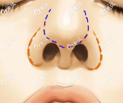 鼻头的组成部分