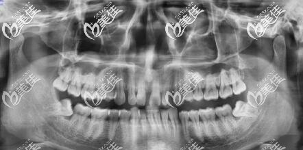 口腔拍片ct南昌维乐口腔 口腔拍片ct南昌维乐口腔