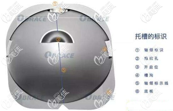 觉得苏州隐形矫正贵,不如选择欧睛球面自锁托槽 觉得苏州隐形矫正贵,不如选择欧睛球面自锁托槽