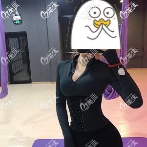 胳膊吸脂术后15天没有太大效果