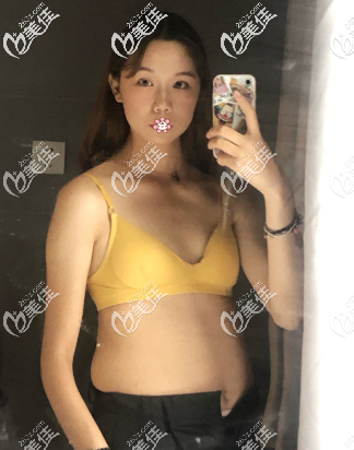 我术前的样子 我术前的样子