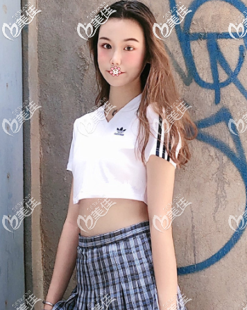 3个月完全恢复好了 3个月完全恢复好了