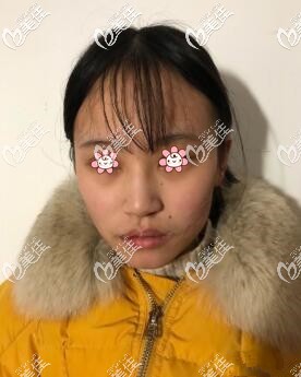 半个月以后 半个月以后