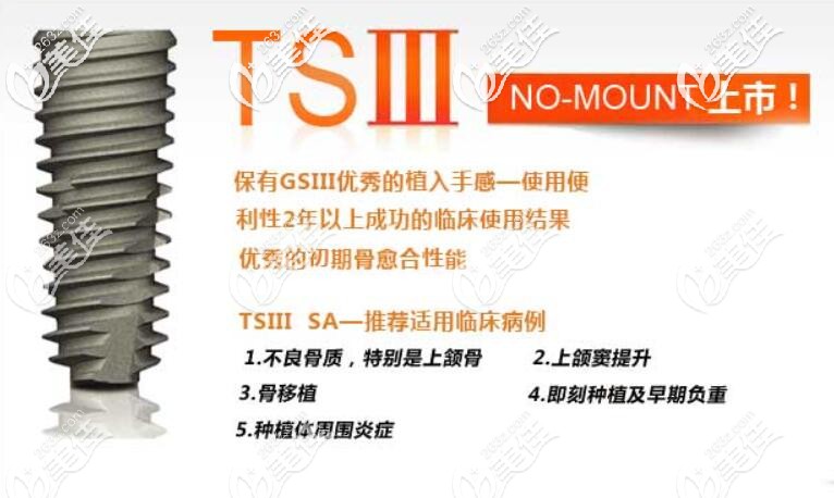 奥齿泰种植体怎么样 奥齿泰种植体怎么样