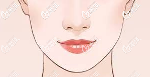 流畅的下颌缘线条