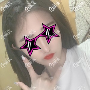 埋线提升术后3天下垂改善明显 埋线提升术后3天下垂改善明显