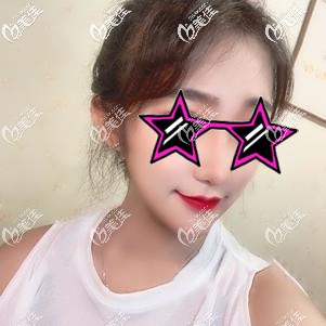 埋线提升术后30天拉扯感渐消 埋线提升术后30天拉扯感渐消