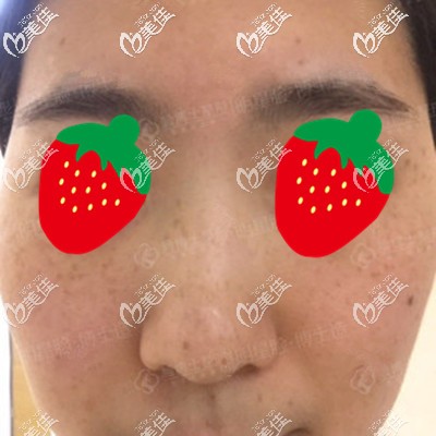 这是满脸雀斑的我 这是满脸雀斑的我