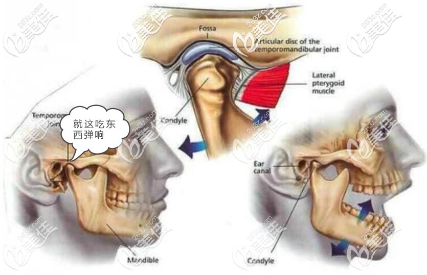 前牙深覆盖不矫正会怎么样 前牙深覆盖不矫正会怎么样