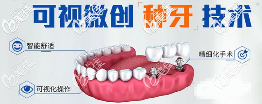 微创种植牙技术 微创种植牙技术