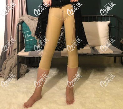 在烟台鹏爱做手术后的第2天