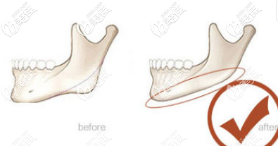 20200617_1592390251447888.png image.png