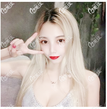 看我的隆胸案例就知道许扬滨隆胸技术真的太好了 看我的隆胸案例就知道许扬滨隆胸技术真的太好了