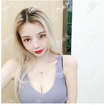 看我找许扬滨做的隆胸效果怎么样 看我找许扬滨做的隆胸效果怎么样