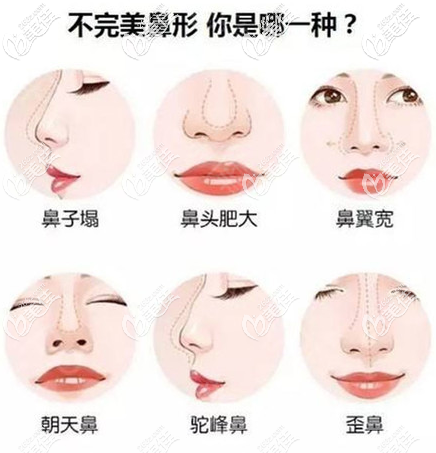 不同鼻子形态 不同鼻子形态