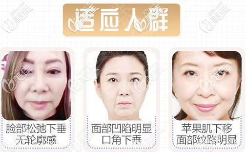 v美减龄适应人群