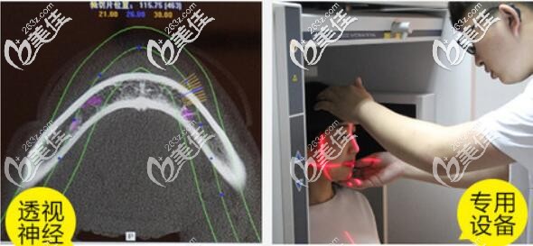 杭州华山连天美磨骨设备 杭州华山连天美磨骨设备