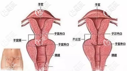 谷春霞医生擅长做阴道紧缩术 谷春霞医生擅长做阴道紧缩术