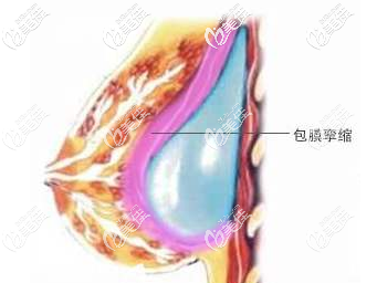 20200619_1592549309939982.png image.png