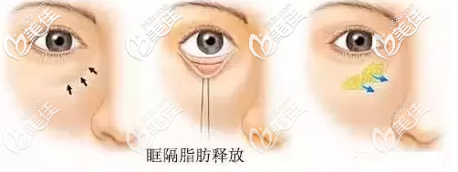 20200619_1592549877280118.png image.png