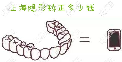 上海隐形牙套矫正要多少钱