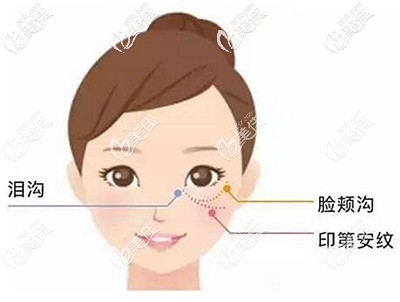 印第安纹所在的面部位置 印第安纹所在的面部位置