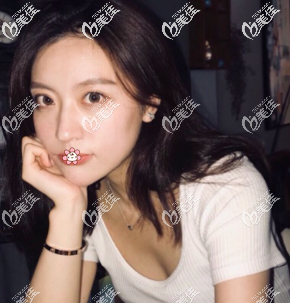 两个月后 两个月后