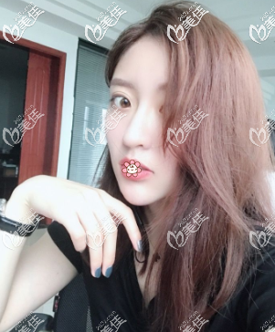 恢复差不多了 恢复差不多了