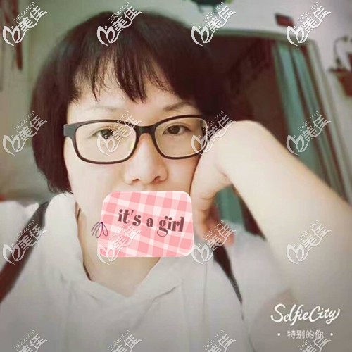 纹眉一年后眉毛基本看不出来 纹眉一年后眉毛基本看不出来