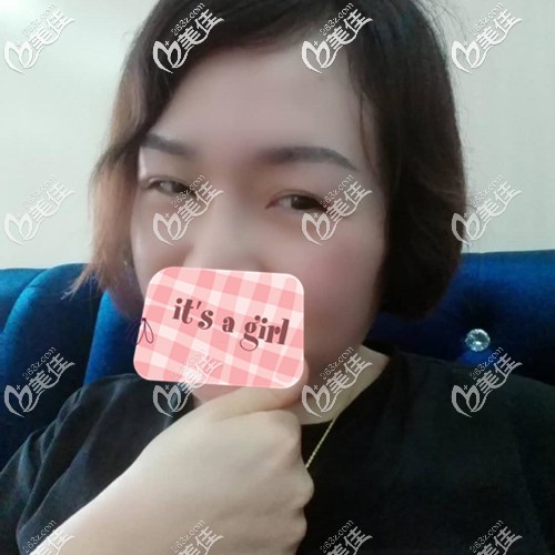 眉毛种植术后2个月进入脱落期 眉毛种植术后2个月进入脱落期