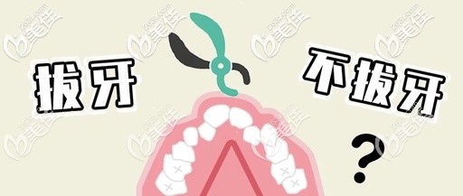 	矫正牙齿让拔牙好还是不拔牙好