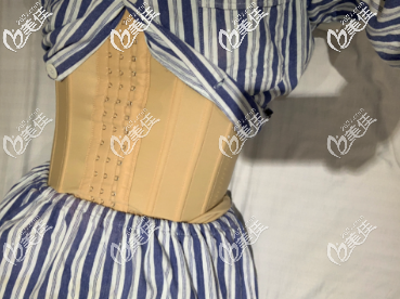 在青岛诺美德做腰腹吸脂手术后的第三天