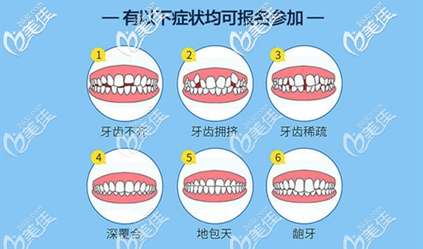 所以牙齿畸形都可参与活动哦