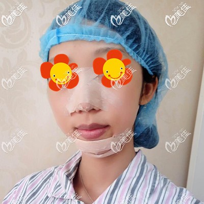 做完手术第3天效果 做完手术第3天效果