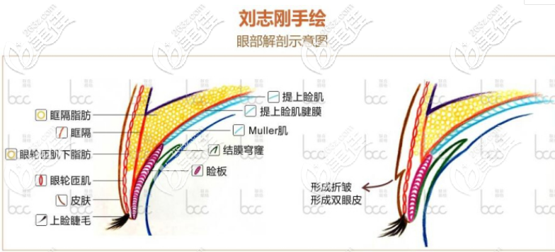 眼睛手术的部位 眼睛手术的部位