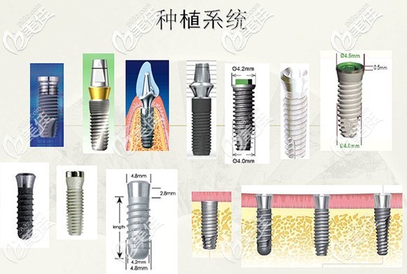 国产和进口的各品牌种植体示意图