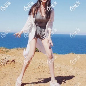 虽然找宁波壹加壹郭光烨做大腿吸脂瘦了不少，但以后也要注意饮食习惯