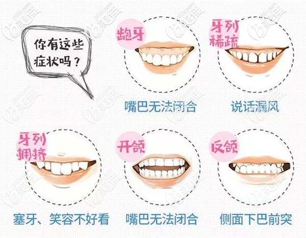 口腔许晓萌介绍牙齿矫正的步骤和流程 口腔许晓萌介绍牙齿矫正的步骤和流程