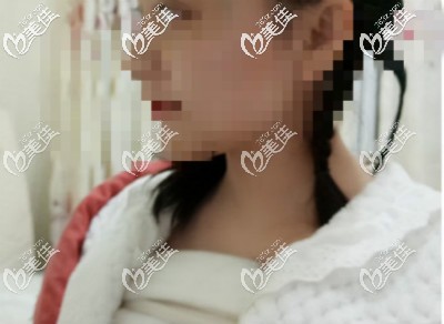 做假体隆胸<span style=