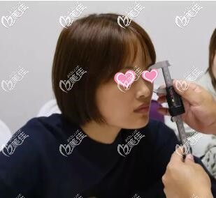 隆鼻术前肖征刚院长面诊 隆鼻术前肖征刚院长面诊