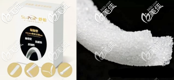 美国舒铂隆鼻假体材料 美国舒铂隆鼻假体材料