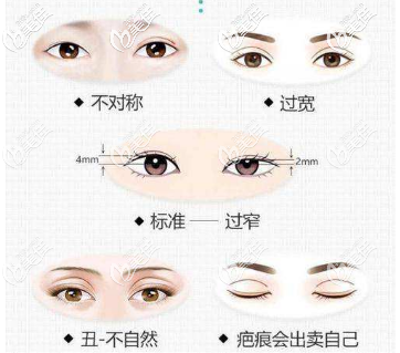 需要修复的双眼皮类型