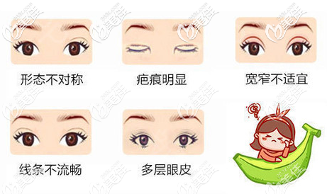 双眼皮失败的几种类型