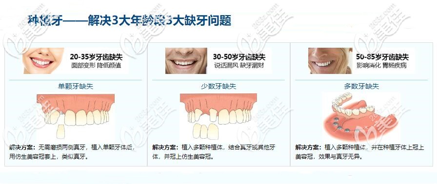 种植牙优势介绍图 种植牙优势介绍图