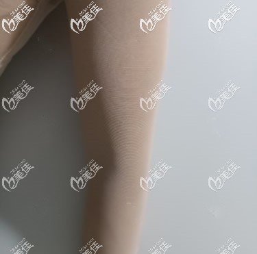 兰州时光逯岩给我做手臂环吸第1天