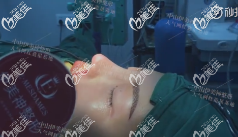 中山伊美神黄中志院长做肋软骨隆鼻修复手术过程图