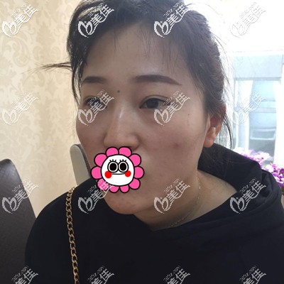 这是做手术前的我 这是做手术前的我